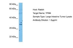 tropomyosin-4 Antibody, Novus Biologicals 100 &mu;L; Unconjugated:Antibodies,